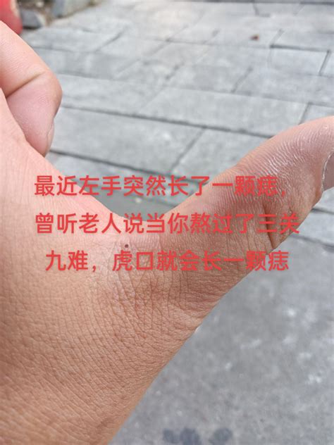 左虎口有痣|左手长痣 左手长痣代表什么